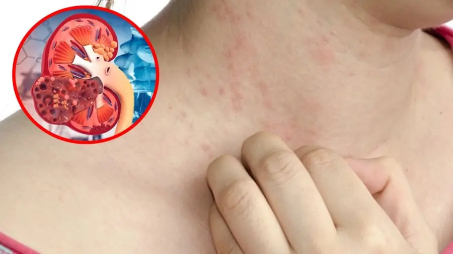 6 Warning Signs of Kid.ney Failure Many People Overlook