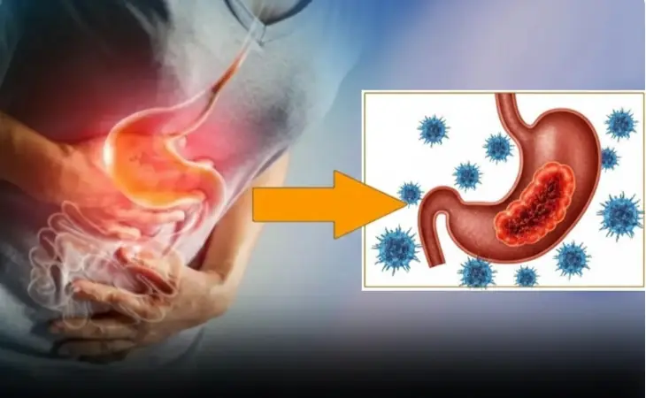 Warning signs of advanced sto.mach can.cer you should never ignore