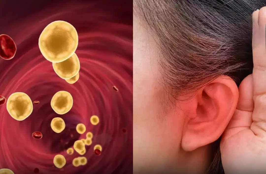 4 Subtle Clues on Your Body That Point to High Blo.o.d Fa.t