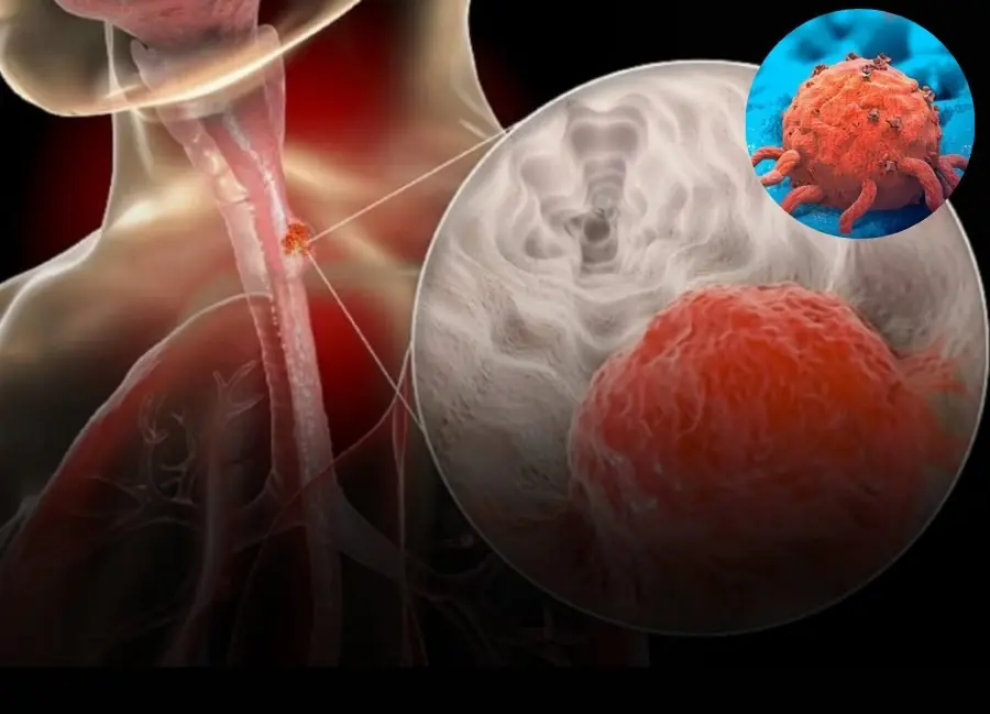 3 Warning about the habit of "welcoming" can:cer into the body