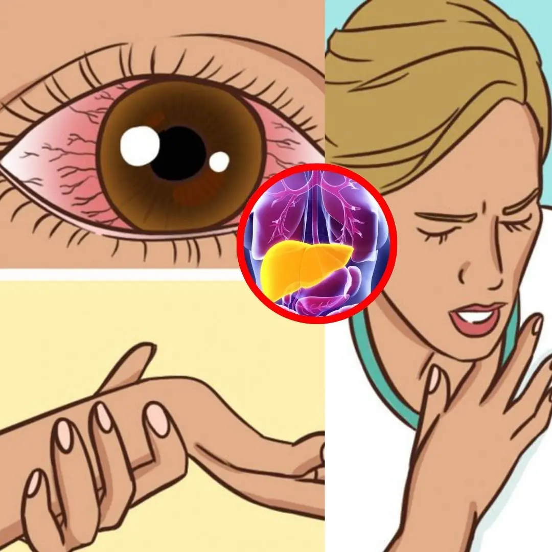 Early Signs of Liver Dam:age & How to Strengthen Your Liver