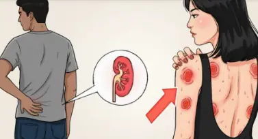 ALERT! 7 Early Signs Your Kidneys Are Crying for Help