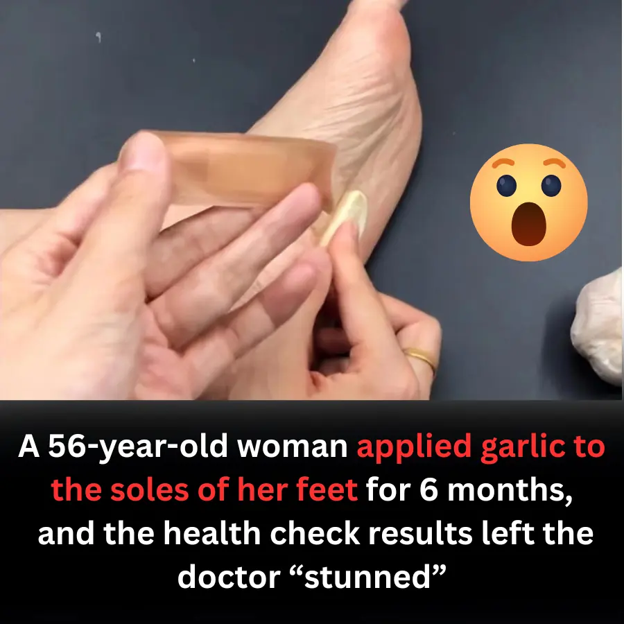 Applying Garlic to the Soles of the Feet for 6 Months: A 56-Year-Old Woman Shocked Doctors With Her Health Check Results