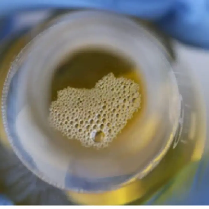 Men and Women Who Notice These 3 Signs in Their Urine Should See a Doctor Immediately