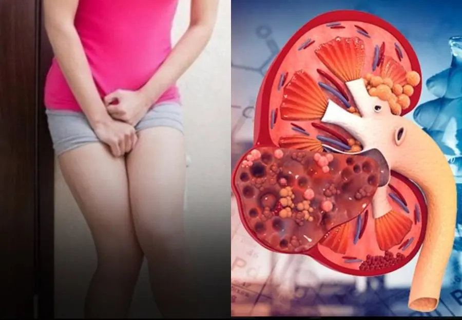 Your Kidneys Are in Trouble If You Notice These Symptoms