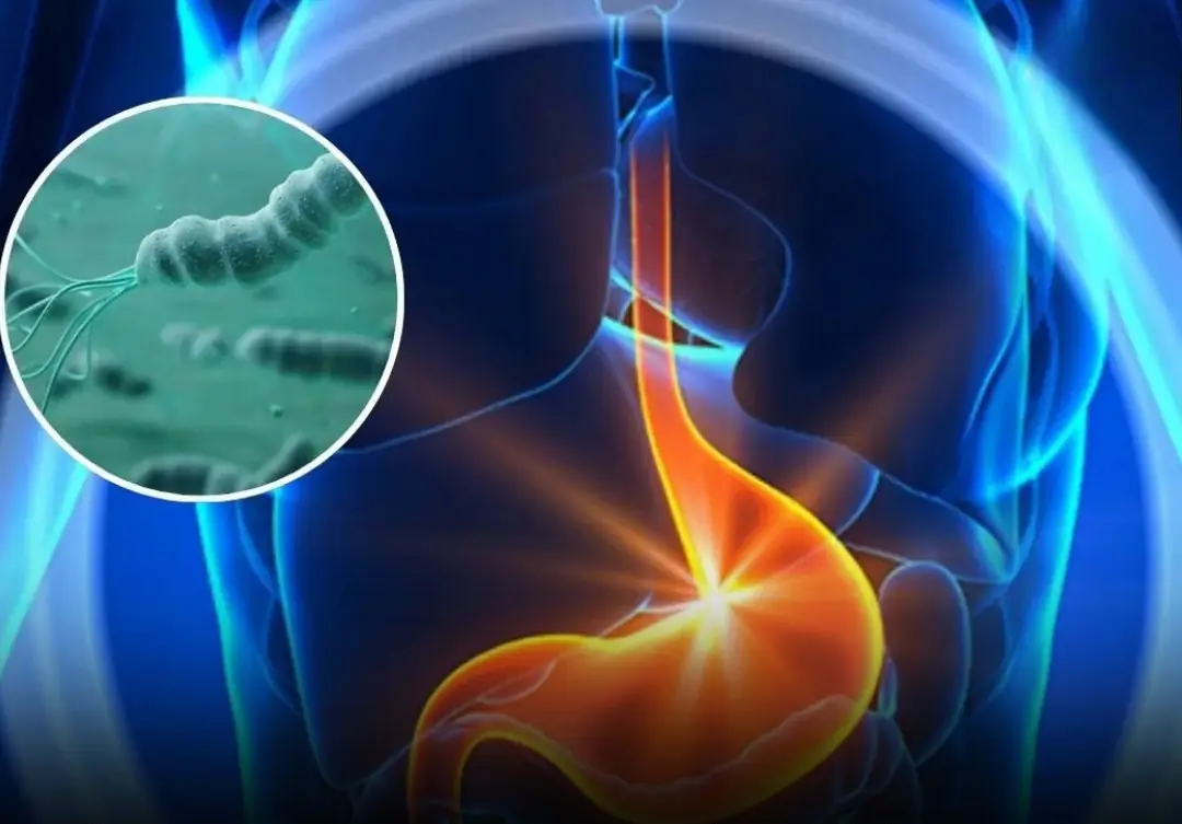 Doctors Warn: Painful Stomach Ulcers May Be Caused by These Harmful Eating Habits