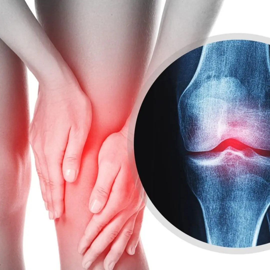 6 foods that silently drain calcium from the body