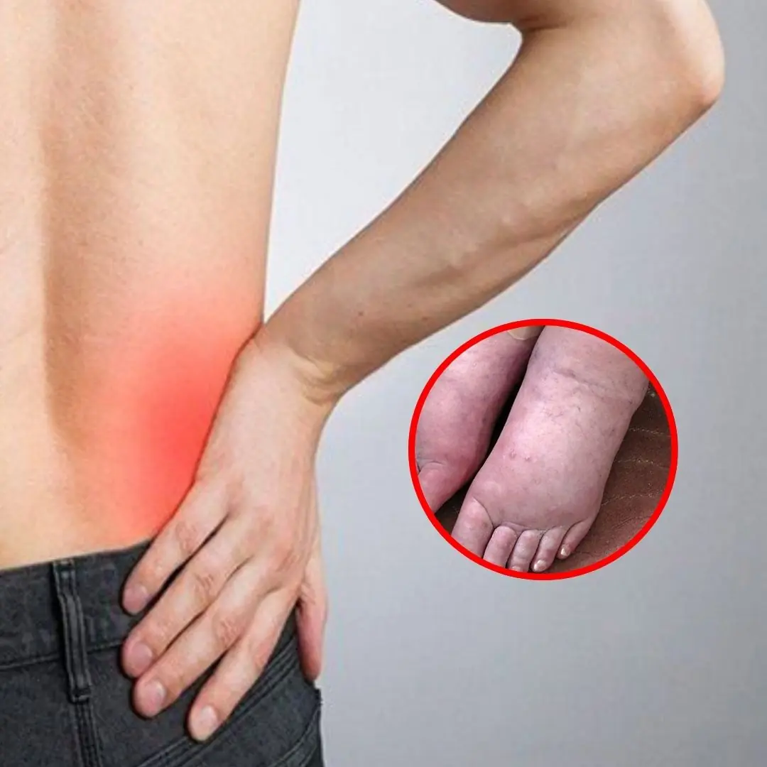 Unusual changes in the body warn that the kidneys are weakening. You should not be subjective