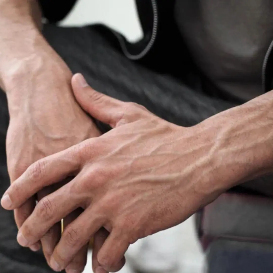 If you see someone with bulging v.eins, you must tell them these things