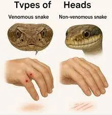 When bitt.en by a snake, you should do these things first