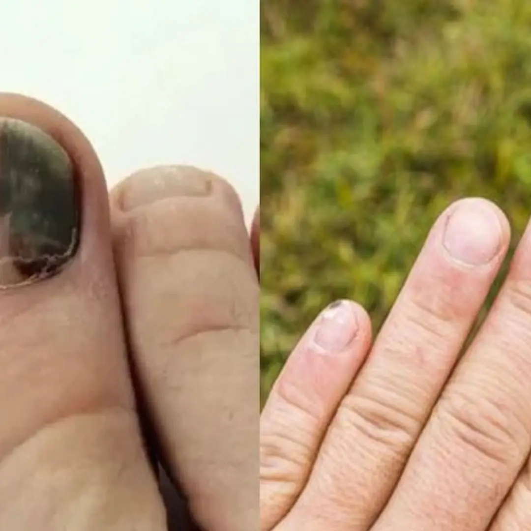 When Cancer Appears, Your Limbs May Show These 3 Alarming Signs