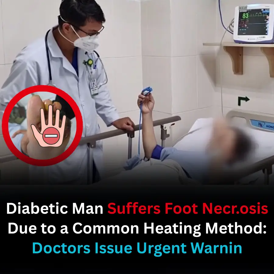 Diabetic Man Suffers Foot Necrosis Due to a Common Heating Method: Doctors Issue Urgent Warning