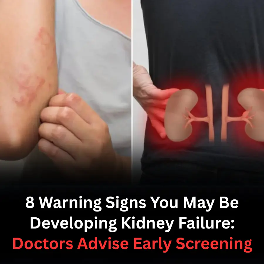 8 Warning Signs You May Be Developing Kidney Failure: Doctors Advise Early Screening