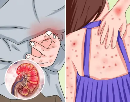 Early Signs of Kidney Disease & How to Protect Your Kidneys (Evidence Based)