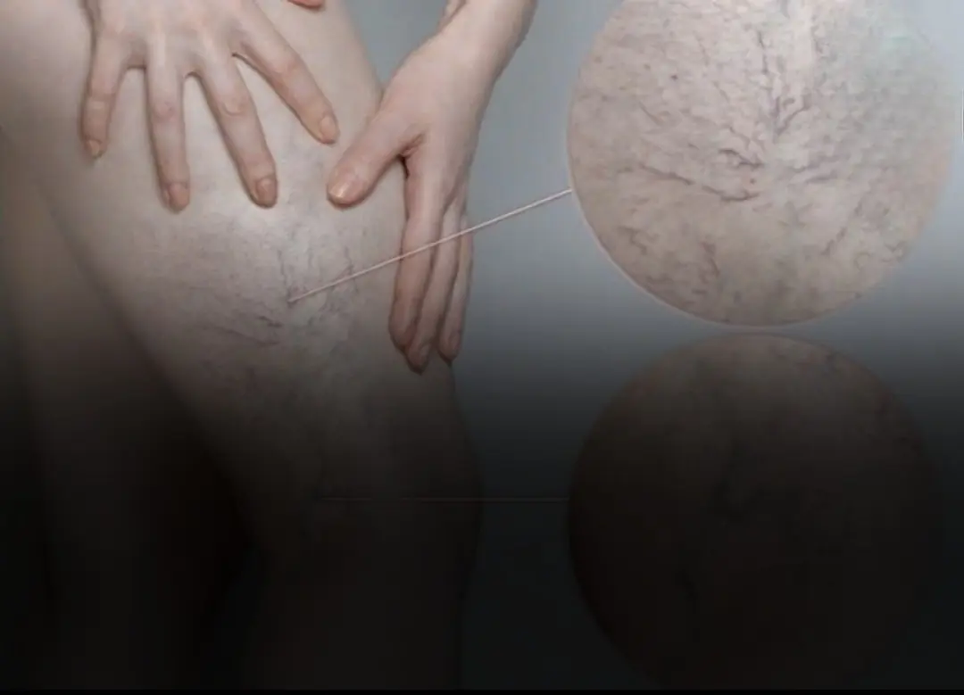 If your legs feel heavy, your feet stay cold, or your veins show more than you'd like, these 6 tips may help