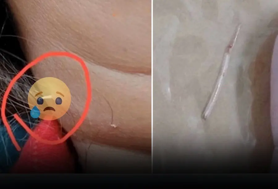 Neck pain, woman shocked to see something sticking out