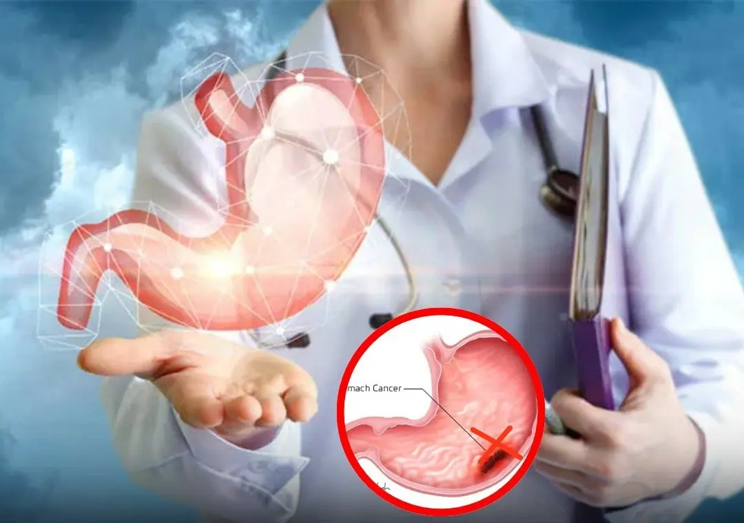 Se você notar esses 5 sintomas após as refeições, faça uma endoscopia o quanto antes!