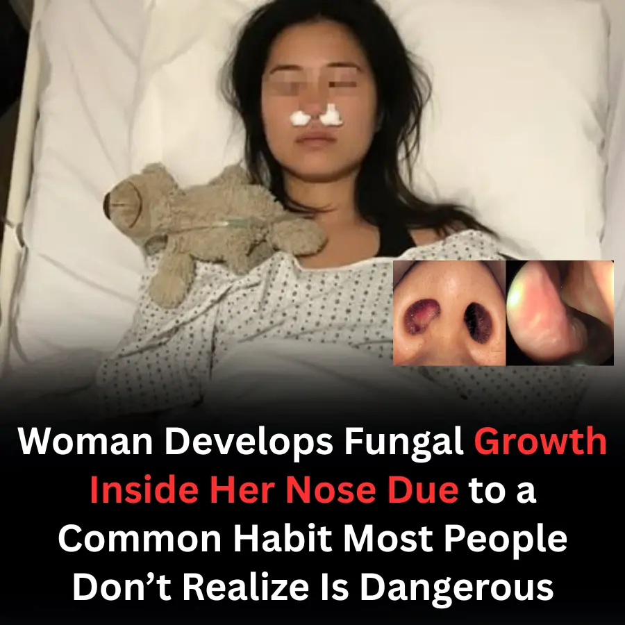 Woman Develops Fungal Growth Inside Her Nose Due to a Common Habit Most People Don’t Realize Is Dangerous