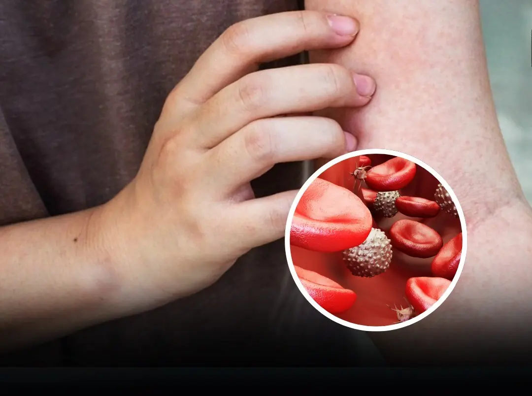 Bl.o.od Ca.n.cer: 10 Subtle Symptoms You Shouldn’t Ignore