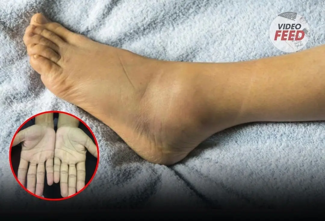 Guys, I need your attention for a moment