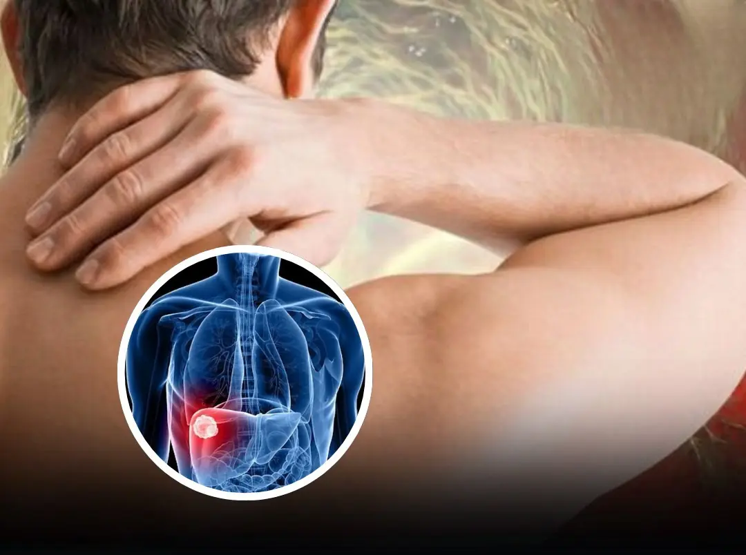 Shoulder discomfort may warn of liver can.cer in its early stages