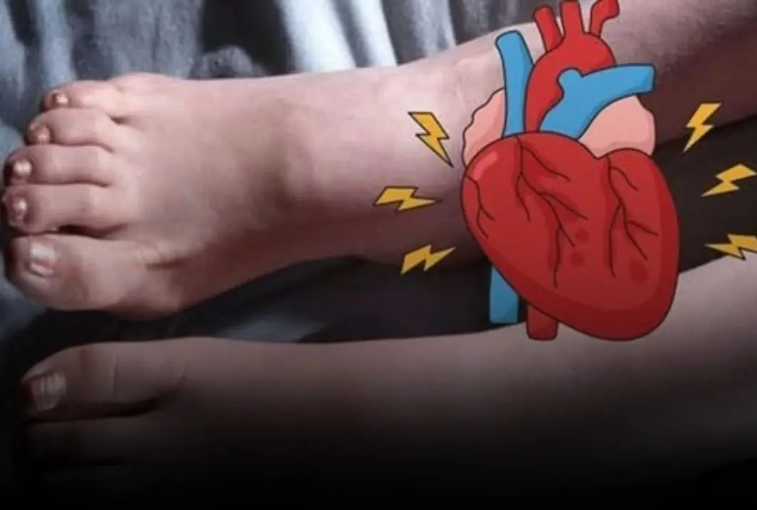 One Month Before a Heart Attack, Your Feet May Warn You With These 6 Signs