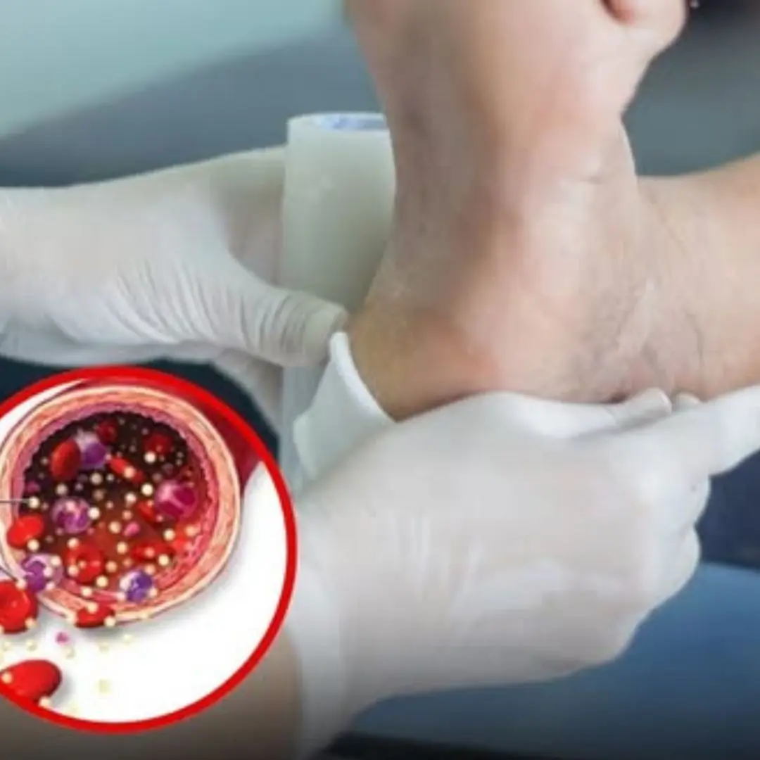 Your feet are a "b.lo.o.d sugar meter" beware of diabetes if you frequently experience these 12 symptoms