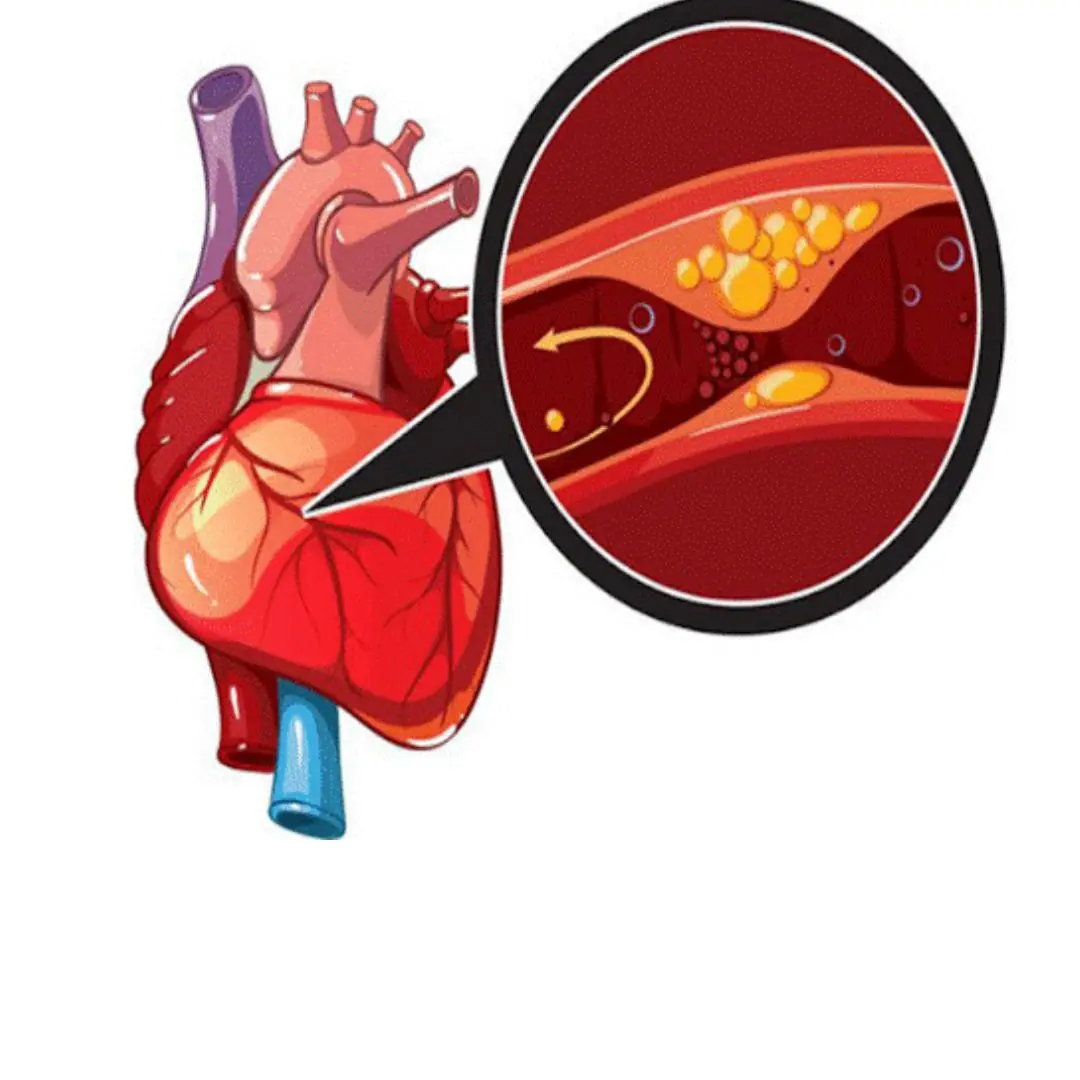High Blood Pressure and High Cholesterol? Avoid These 3 Things Every Morning to Protect Your Health