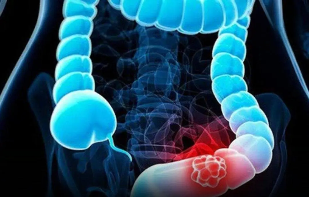 They may look harmless now, but if ignored, these signs could slowly lead to c.an.cer