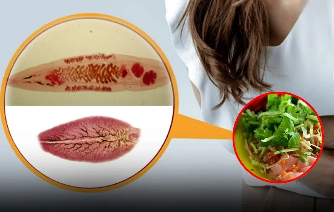 How your daily eating habits could expose you to liver fluke infection