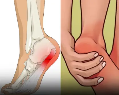 7 Powerful Exercises to Relieve Heel Pain and Treat Plantar Fasciitis Naturally