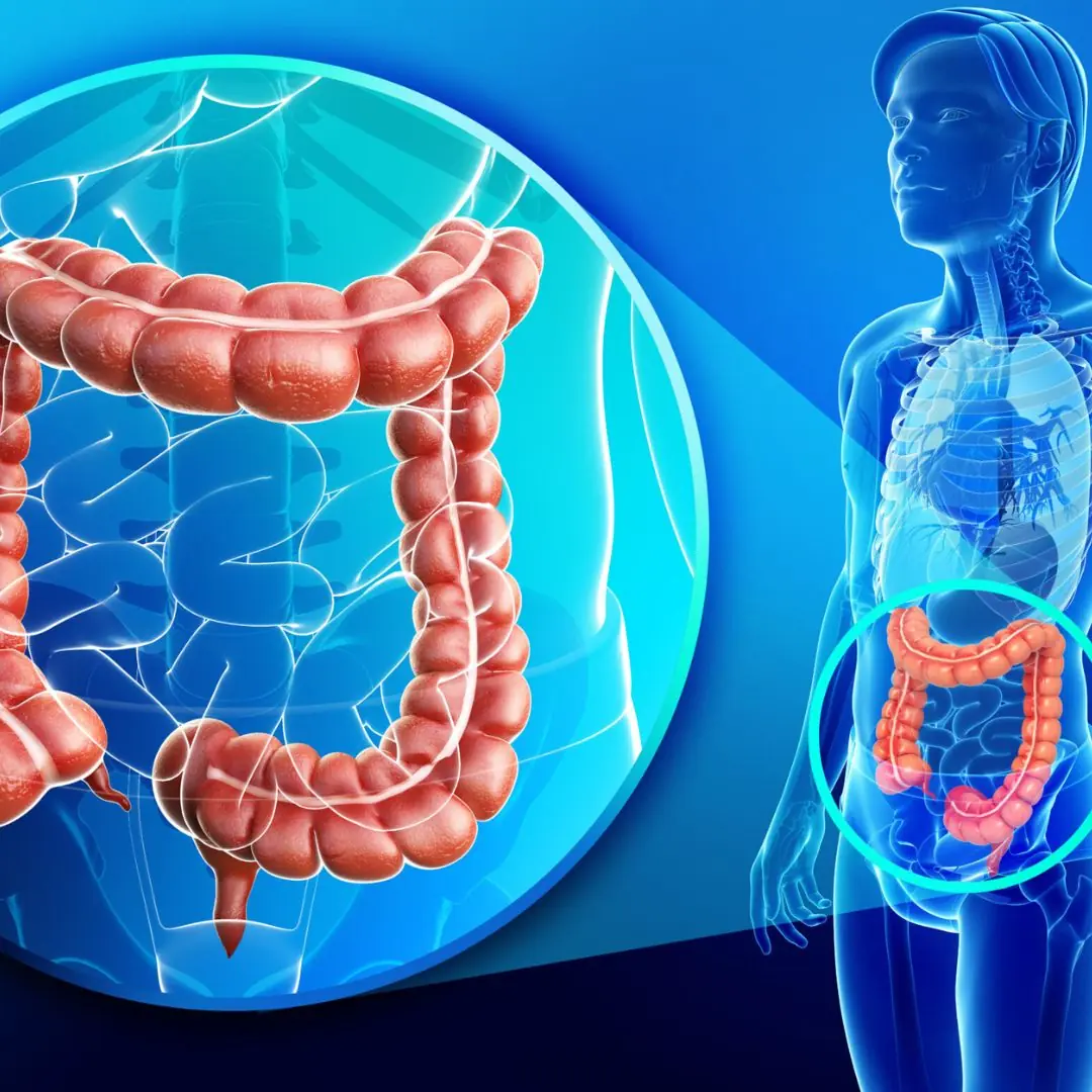 Common routines you ignore every day that may raise your risk of colon cancer