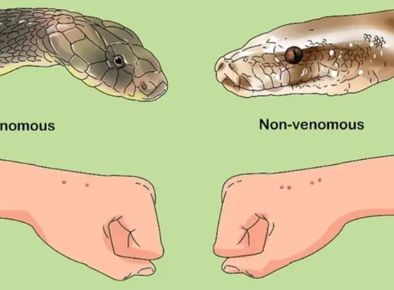 When bit.ten by a snake, you should do these things first