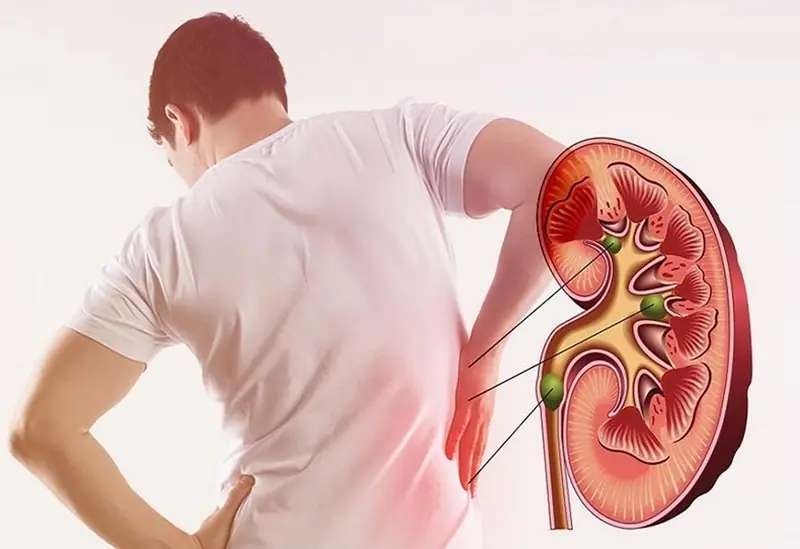 Kidney failure doesn’t happen overnight: 8 signs that demand immediate attention