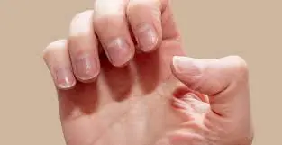 Look at your nails to predict your health. If your nails have these 3 points, see a doctor immediately before you re.gret it