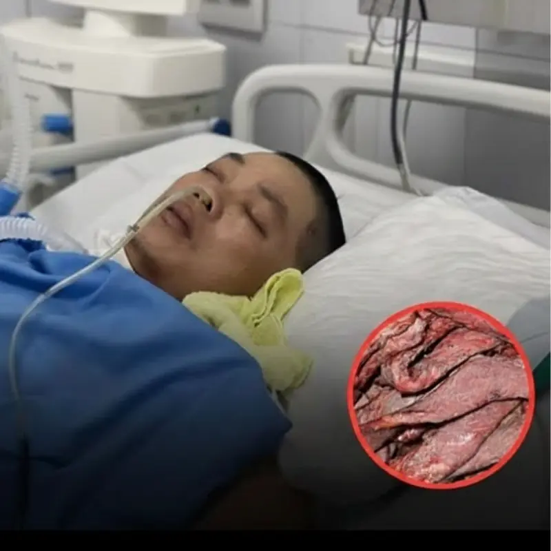 The More You Eat This Type of Meat, the Greater the Danger: Over 2,800 People Linked to Bra.in Damage and High Blo.od Pressure