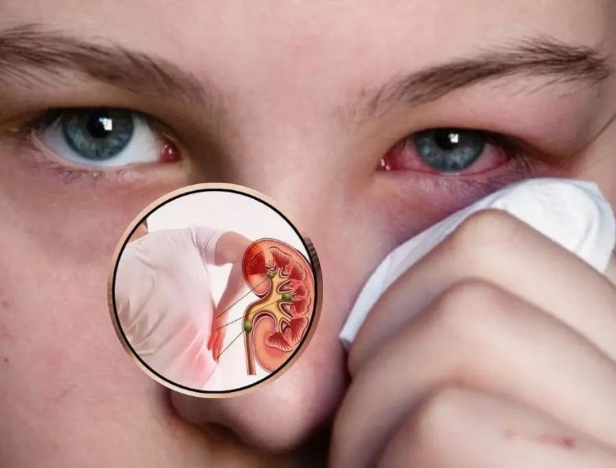 8 signs of kid.ney failure that if ignored may require lifelong dialysis