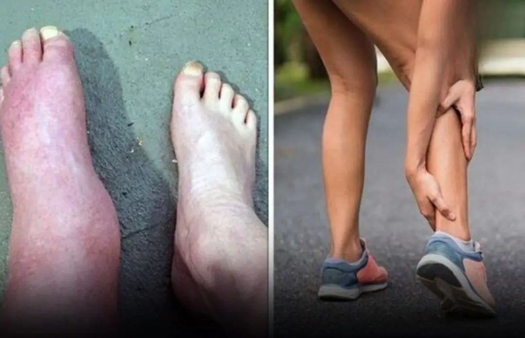 The Foot Symptom That Signals the Damage May Be Irreversible