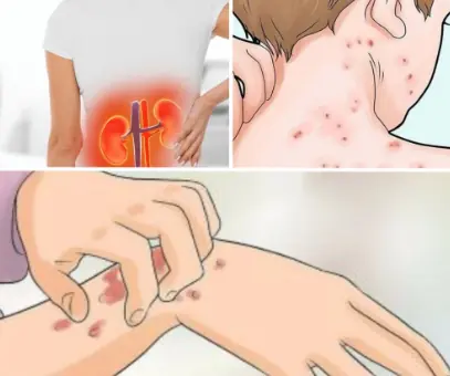 If Your Kidneys Are in Danger, the Body Will Show these 10 Signs