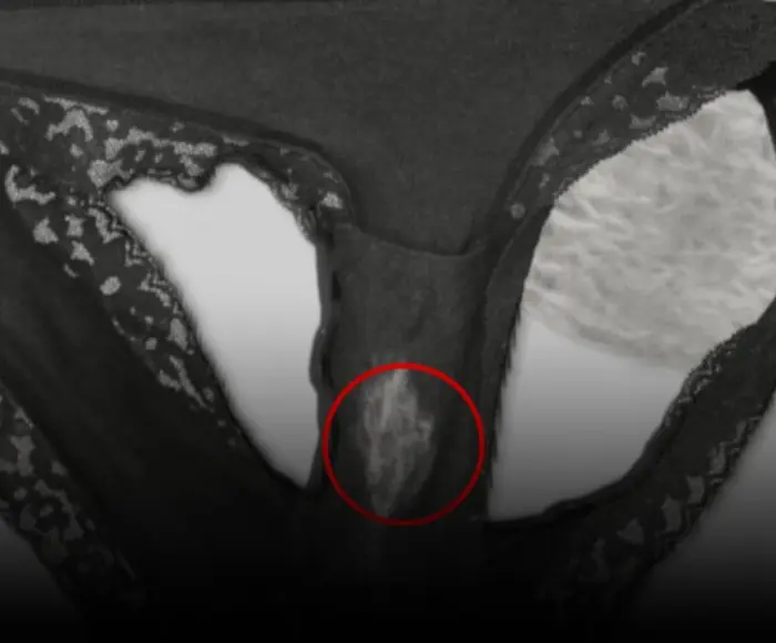 If you find a “Bleach” patch in your underwear - What it really means?