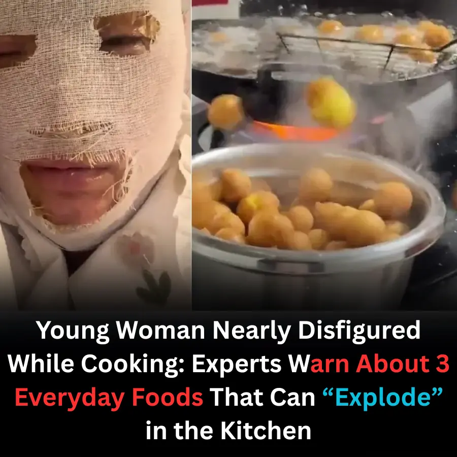 3 everyday foods that can explode while cooking — one nearly disfigured a young woman