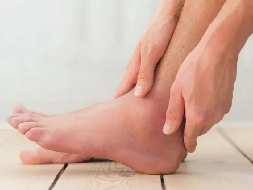 5 unusual foot symptoms that could signal kid.ney trouble