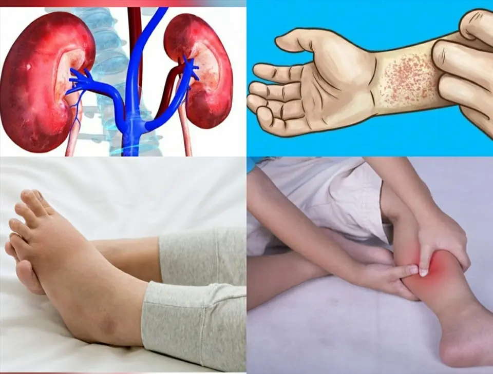 5 skin signs that could be warning you about kid.ney problems