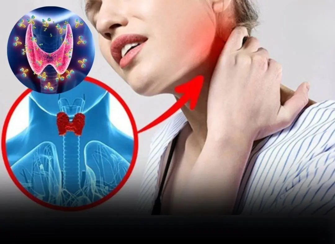 5 Early Signs of Thyroid Cancer That Are Easy to Recognize