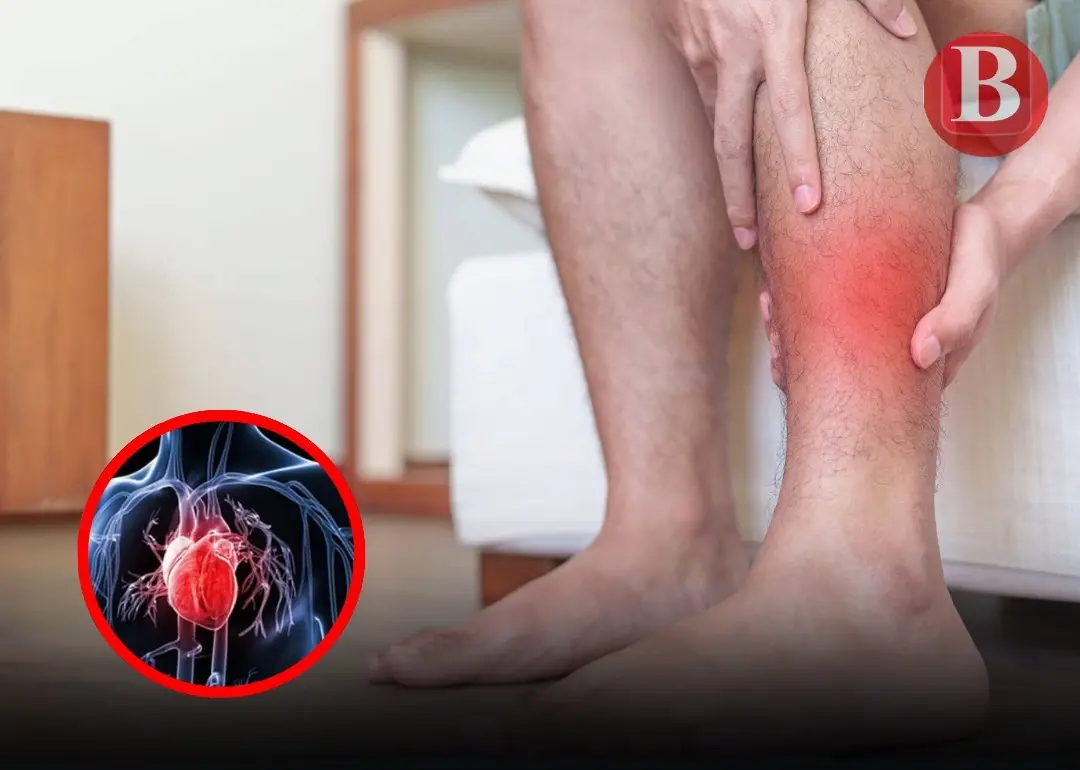 Your body may alert you to an upcoming heart attack with 5 key symptoms — often appearing 3 months early