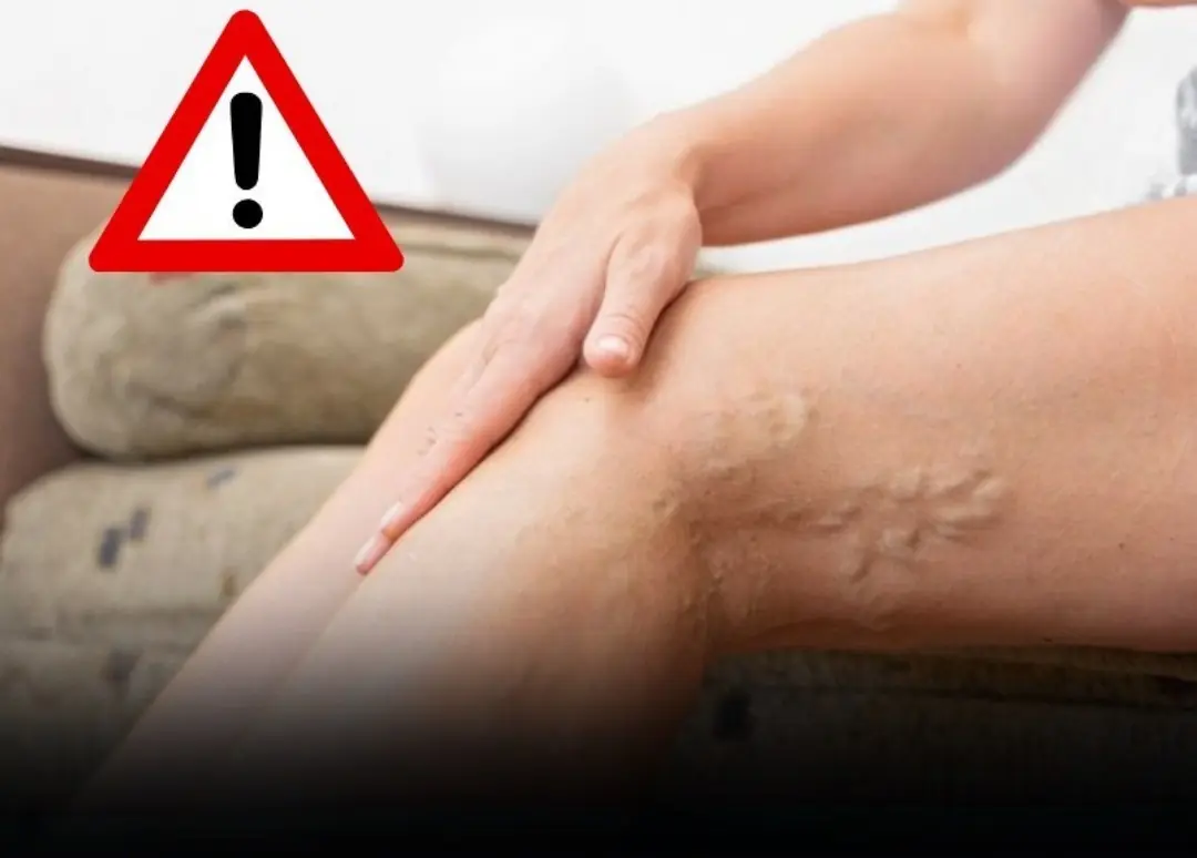 Early Cervical Cancer Clues? Don’t Ignore These 4 Foot Warning Signs