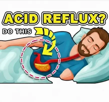 3 Ways to Stop Acid Reflux Naturally