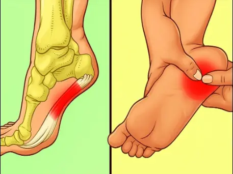 7 Powerful Exercises to Relieve Heel Pain and Treat Plantar Fasciitis Naturally