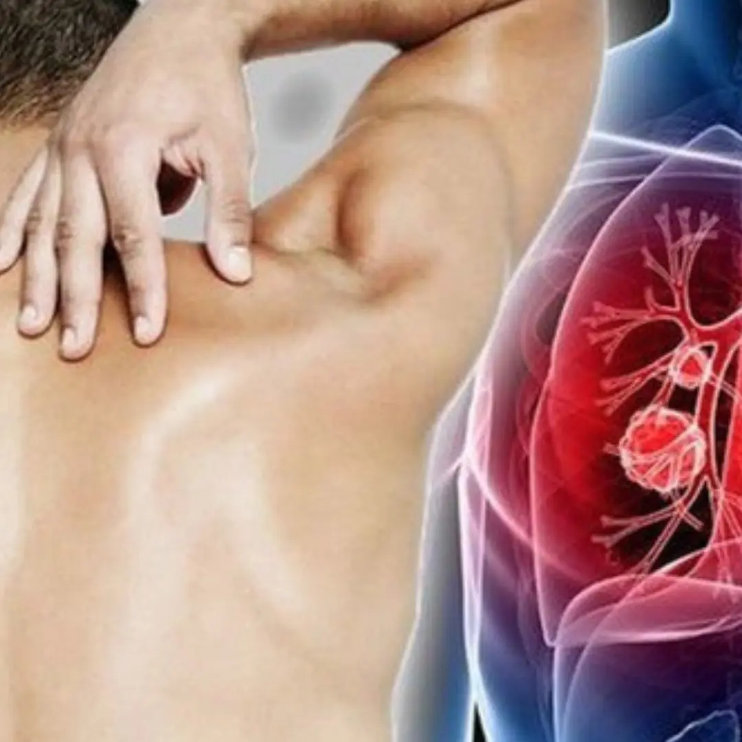 A 29-year-old man unexpectedly discovered he had lung cancer and admitted to a mistake many Vietnamese men make