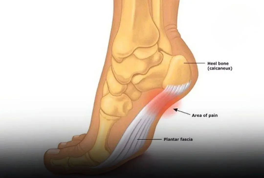 Frequent leg numbness: What’s causing it and should you be worried?